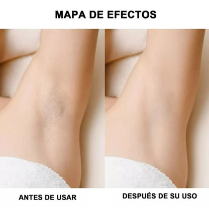 DEPILADORA MULTIUSOS PORTÁTIL